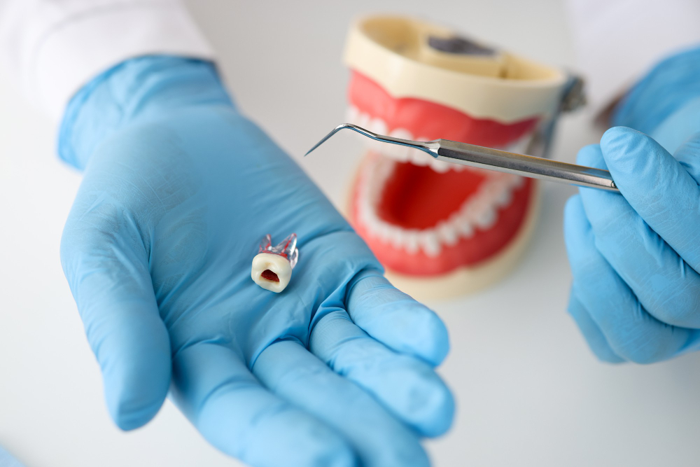 dentist-doctor-hand-glove-shows-tooth-root-canal-infection-symptoms-concept